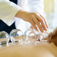 吸玉（カッピング）